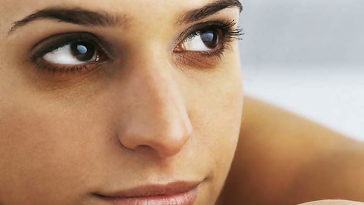 How to get rid of dark circles under your eyes permanently