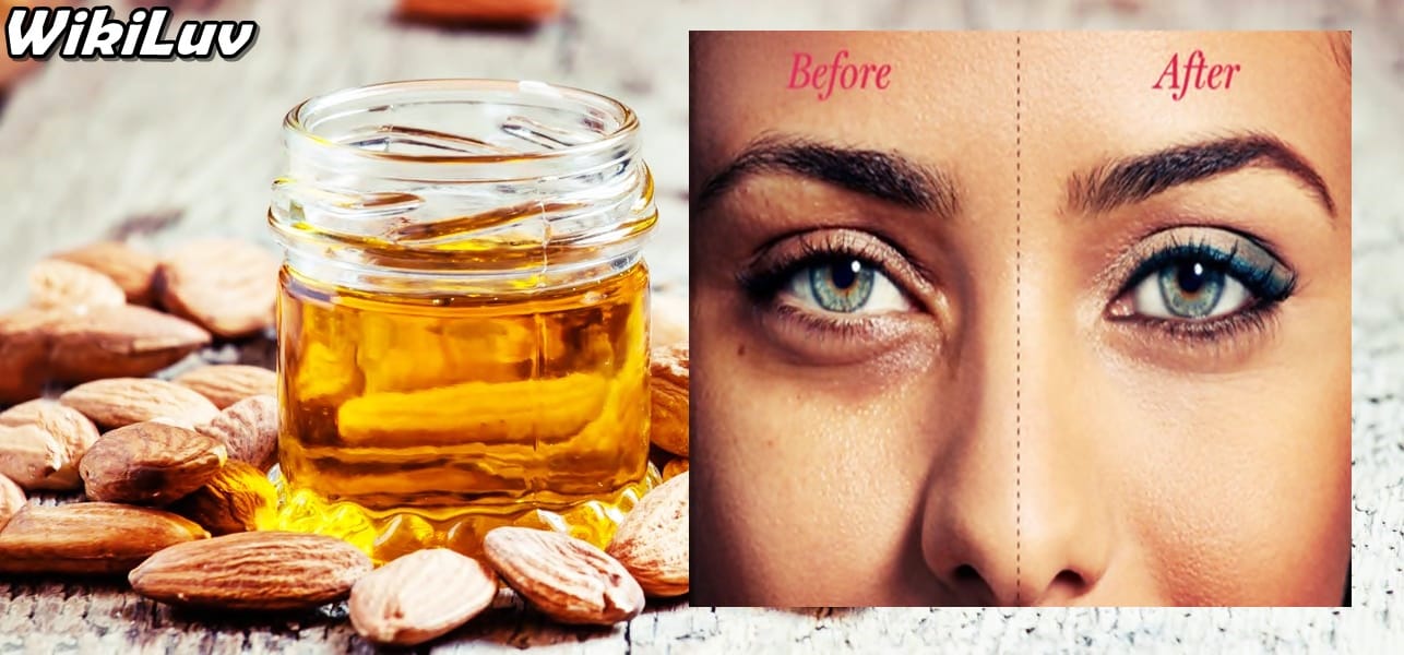 How to get rid of dark circles under your eyes permanently