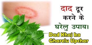 dad khaj ka gharelu upchar
