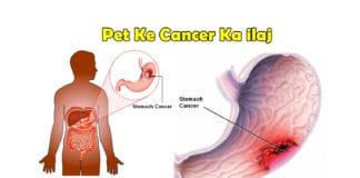 pet ke cancer ka ilaj upchar