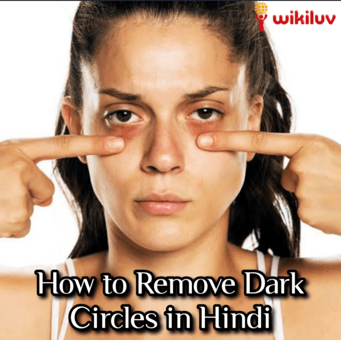 डार्क सर्कल्स Wikiluv, wikiluv.com, www.wikiluv.com, विकिलव, विकिपीडिया, wikipedia, How to Remove Dark Circles in Hindi, आंखों के काले घेरे हटाने के घरेलू उपाय, त्वचा के लिए बादाम तेल के फायदे, Benefits of almond oil to the skin, How to Remove Dark Circles, काले घेरे हटाने के घरेलू उपाय, बादाम तेल, Almond Oil, बादाम तेल को त्वचा पर लगाने का तरीका, How to apply almond oil on the skin, Almond oil benefits for dark circle, त्वचा से दाग - धब्बे , डार्क स्पॉट, झाइयां, और आँखों के नीचे हुए काले घेरे हटाने का उपाय, दाग धब्बे हटाने के उपाय, डार्क सर्कल हटाने के उपाय, डार्क स्पॉट हटाने के उपाय, झाइयां हटाने के उपाय, चेहरे के दाग धब्बे कम कैसे करें, चेहरे की झाइयों को कम कैसे करें, आँखों के नीचे के काले घेरे कैसे कम करें, घरेलू उपाय से दाग धब्बे कैसे हटाए, ऑर्गन तेल, Argan oil, त्वचा के लिए ऑर्गन तेल के फायदे, Benefits of argan oil to the skin, आर्गन तेल से डार्क सर्कल्स हटाने के नुस्खे, Argan oil good for dark circles, ऑर्गन तेल काले घेरे हटाने के घरेलू नुस्खे, ऑर्गन तेल से आँखों के नीचे के काले घेरे हटाने के घरेलू नुस्खे, ऑर्गन तेल को त्वचा पर लगाने का तरीका, How to apply argan oil on the skin, नारियल तेल, Coconut oil, त्वचा के लिए नारियल तेल के फायदे, Benefits of coconut oil for skin, नारियल के तेल से काले घेरे हटाने के अचूक घरेलू उपाय, नारियल के तेल से काले घेरे खत्म करने के घरेलू नुस्खे, नारियल का तेल काले घेरे हटाने का अचूक घरेलू उपाय, Coconut oil reduces dark circles, नारियल तेल को त्वचा पर लगाने का तरीका , Method of applying coconut oil on the skin, एलोवेरा जेल, Aloe vera gel , त्वचा के लिए एलोवेरा जेल के फायदे,Benefits of aloe vera gel for skin, एलोवेरा से काले घेरे कम करने के उपाय, एलोवेरा के फायदे, एलोवेरा से दाग धब्बे दूर करे, एलोवेरा से दाग धब्बे दूर करने के उपाय, घरेलू नुस्खे से दाग धब्बे दूर कैसे करें, आंखों के नीचे कालापन दूर करने का उपाय करें एलो वेरा जेल से, Aloe vera gel for dark circles, एलोवेरा जेल को लगाने का तरीका,How to apply aloe vera gel on skin, सेब का सिरका,Apple vinegar, त्वचा के लिए सेब के सिरके के फायदे , Benefits of apple vinegar for skin, डार्क सर्कल्स हटाने का घरेलू उपाय, सेब के सिरके से काले घेरे हटाने के उपाय, Apple cider vinegar treats dark circles, त्वचा पर के सेब के सिरके को लगाने का तरीका,How to apply apple vinegar on the skin, सेब के सिरके के उपाय, त्वचा पर सेब को लगाने के तरीके, dark circles removal tips in hindi,2 दिनों में काले घेरे दूर करने के लिए कैसे,घर पर काले घेरे दूर करने के लिए कैसे,आंखों के नीचे डार्क सर्कल हटाने के घरेलू उपाय, डार्क सर्कल, काले घेरे, काले दाग धब्बे, dark circle, kale ghere, dark circle hatane ke upay, aankhon ke niche ke kale ghere kaise hataye,Dark circle hatane ke upay in hindi, how to remove dark circle, आंखों के नीचे काले घेरे, आंखों के काले घेरे दूर करने के घरेलू उपाय, Dark Circle Kaise Hataye, जानिए आंखों के नीचे डार्क सर्कल हटाने के घरेलू उपाय,डार्क सर्कल दूर करने के आसान तरीके,home remedies to get rid of dark circles , Dark Circles Home Remediesin hindi, how to cure dark circles at home, MensXP, navbharattimes, stylecraze,hindisahayta,myupchar, patrika,deepawali, popxo, merisaheli, boldsky, Dailymotion, dailyhunt, 1mg,
